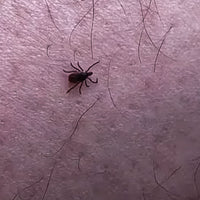 Five tips for tick prevention and avoidance